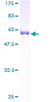 TPM4 Protein - 12.5% SDS-PAGE of human TPM4 stained with Coomassie Blue