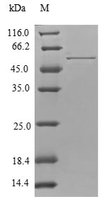 TPM4 Protein - (Tris-Glycine gel) Discontinuous SDS-PAGE (reduced) with 5% enrichment gel and 15% separation gel.