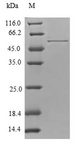 TPM4 Protein - (Tris-Glycine gel) Discontinuous SDS-PAGE (reduced) with 5% enrichment gel and 15% separation gel.