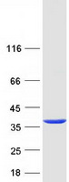 TPM4 Protein - Purified recombinant protein TPM4 was analyzed by SDS-PAGE gel and Coomassie Blue Staining