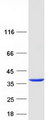 TPM4 Protein - Purified recombinant protein TPM4 was analyzed by SDS-PAGE gel and Coomassie Blue Staining
