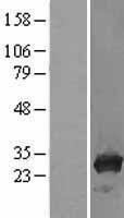 TPMT Protein - Western validation with an anti-DDK antibody * L: Control HEK293 lysate R: Over-expression lysate