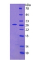TPMT Protein - Recombinant Thiopurine Methyltransferase By SDS-PAGE