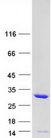TPMT Protein - Purified recombinant protein TPMT was analyzed by SDS-PAGE gel and Coomassie Blue Staining