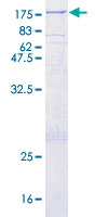 TPO / Thyroid Peroxidase Protein - 12.5% SDS-PAGE of human TPO stained with Coomassie Blue
