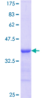 TPO / Thyroid Peroxidase Protein - 12.5% SDS-PAGE Stained with Coomassie Blue.