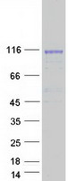 TPO / Thyroid Peroxidase Protein - Purified recombinant protein TPO was analyzed by SDS-PAGE gel and Coomassie Blue Staining