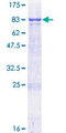 TPP1 / CLN2 Protein - 12.5% SDS-PAGE of human TPP1 stained with Coomassie Blue