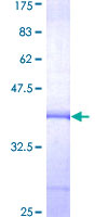 TPP1 / CLN2 Protein - 12.5% SDS-PAGE Stained with Coomassie Blue.