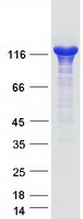 TPP2 Protein - Purified recombinant protein TPP2 was analyzed by SDS-PAGE gel and Coomassie Blue Staining