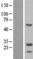TPPP Protein - Western validation with an anti-DDK antibody * L: Control HEK293 lysate R: Over-expression lysate