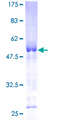 TPPP Protein - 12.5% SDS-PAGE of human TPPP stained with Coomassie Blue