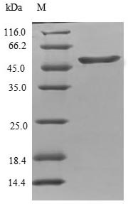 TPPP Protein - (Tris-Glycine gel) Discontinuous SDS-PAGE (reduced) with 5% enrichment gel and 15% separation gel.