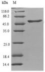 TPPP Protein - (Tris-Glycine gel) Discontinuous SDS-PAGE (reduced) with 5% enrichment gel and 15% separation gel.