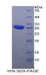 TPPP Protein - Recombinant Tubulin Polymerization Promoting Protein By SDS-PAGE