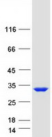 TPPP Protein - Purified recombinant protein TPPP was analyzed by SDS-PAGE gel and Coomassie Blue Staining