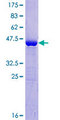 TPPP3 Protein - 12.5% SDS-PAGE of human CGI-38 stained with Coomassie Blue