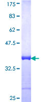 TPR Protein - 12.5% SDS-PAGE Stained with Coomassie Blue.