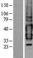 TPRA1 / GPR175 Protein - Western validation with an anti-DDK antibody * L: Control HEK293 lysate R: Over-expression lysate