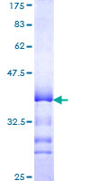 TPRA1 / GPR175 Protein