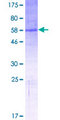 TPRG1 Protein - 12.5% SDS-PAGE of human FAM79B stained with Coomassie Blue