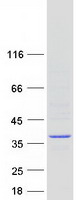 TPRG1 Protein - Purified recombinant protein TPRG1 was analyzed by SDS-PAGE gel and Coomassie Blue Staining