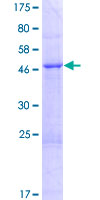 TPRG1L Protein - 12.5% SDS-PAGE of human FAM79A stained with Coomassie Blue
