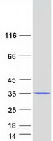 TPRG1L Protein - Purified recombinant protein TPRG1L was analyzed by SDS-PAGE gel and Coomassie Blue Staining