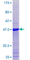 TPRKB Protein - 12.5% SDS-PAGE of human CGI-121 stained with Coomassie Blue