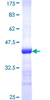 TPRKB Protein - 12.5% SDS-PAGE Stained with Coomassie Blue.