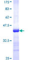 TPRKB Protein - 12.5% SDS-PAGE Stained with Coomassie Blue.