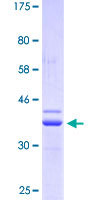 TPRX1 Protein - 12.5% SDS-PAGE Stained with Coomassie Blue.