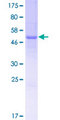 TPSD1 / Tryptase Delta 1 Protein - 12.5% SDS-PAGE of human TPSD1 stained with Coomassie Blue