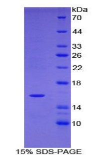 TPSD1 / Tryptase Delta 1 Protein - Recombinant Tryptase Delta 1 By SDS-PAGE