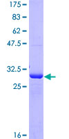 TPST1 Protein - 12.5% SDS-PAGE Stained with Coomassie Blue.
