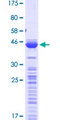TPT1 / TCTP Protein - 12.5% SDS-PAGE of human TPT1 stained with Coomassie Blue