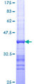 TPT1 / TCTP Protein - 12.5% SDS-PAGE Stained with Coomassie Blue.