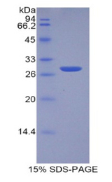 TPT1 / TCTP Protein - Recombinant Tumor Protein, Translationally Controlled 1 By SDS-PAGE