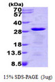 TPT1 / TCTP Protein