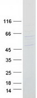 TPTE Protein - Purified recombinant protein TPTE was analyzed by SDS-PAGE gel and Coomassie Blue Staining