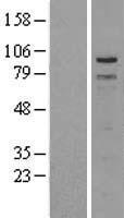 TPX2 Protein - Western validation with an anti-DDK antibody * L: Control HEK293 lysate R: Over-expression lysate