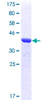 TPX2 Protein - 12.5% SDS-PAGE Stained with Coomassie Blue