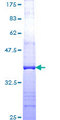 Tra1 / TRRAP Protein - 12.5% SDS-PAGE Stained with Coomassie Blue.
