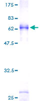 TRA2B / SFRS10 Protein - 12.5% SDS-PAGE of human SFRS10 stained with Coomassie Blue