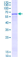 TRABD Protein - 12.5% SDS-PAGE of human TRABD stained with Coomassie Blue
