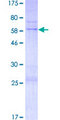 TRADD Protein - 12.5% SDS-PAGE of human TRADD stained with Coomassie Blue