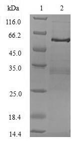 TRADD Protein - (Tris-Glycine gel) Discontinuous SDS-PAGE (reduced) with 5% enrichment gel and 15% separation gel.