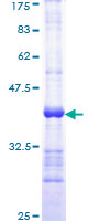 TRADD Protein - 12.5% SDS-PAGE Stained with Coomassie Blue.