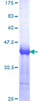 TRAF3 Protein - 12.5% SDS-PAGE Stained with Coomassie Blue.