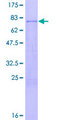 TRAF4 Protein - 12.5% SDS-PAGE of human TRAF4 stained with Coomassie Blue